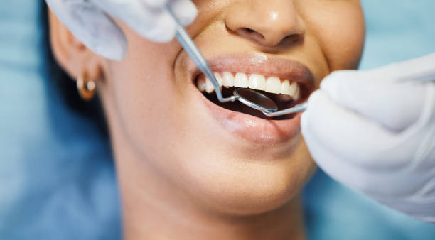 Best Emergency Dental Filling Replacement  in Sugar City, ID