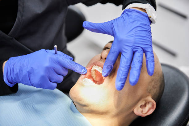 Emergency Dental Filling Replacement in ID